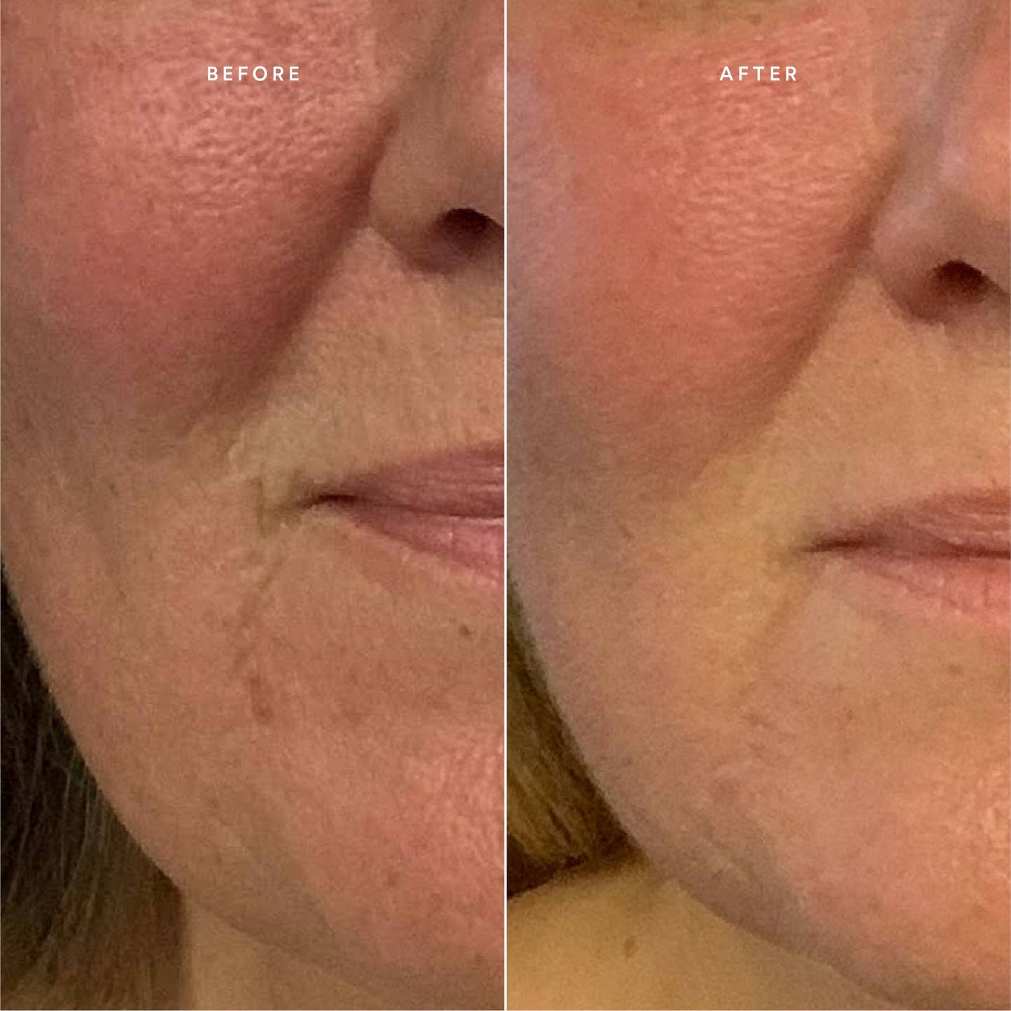 True Botanicals Renew Repair Nightly Treatment (formerly Repair Serum)