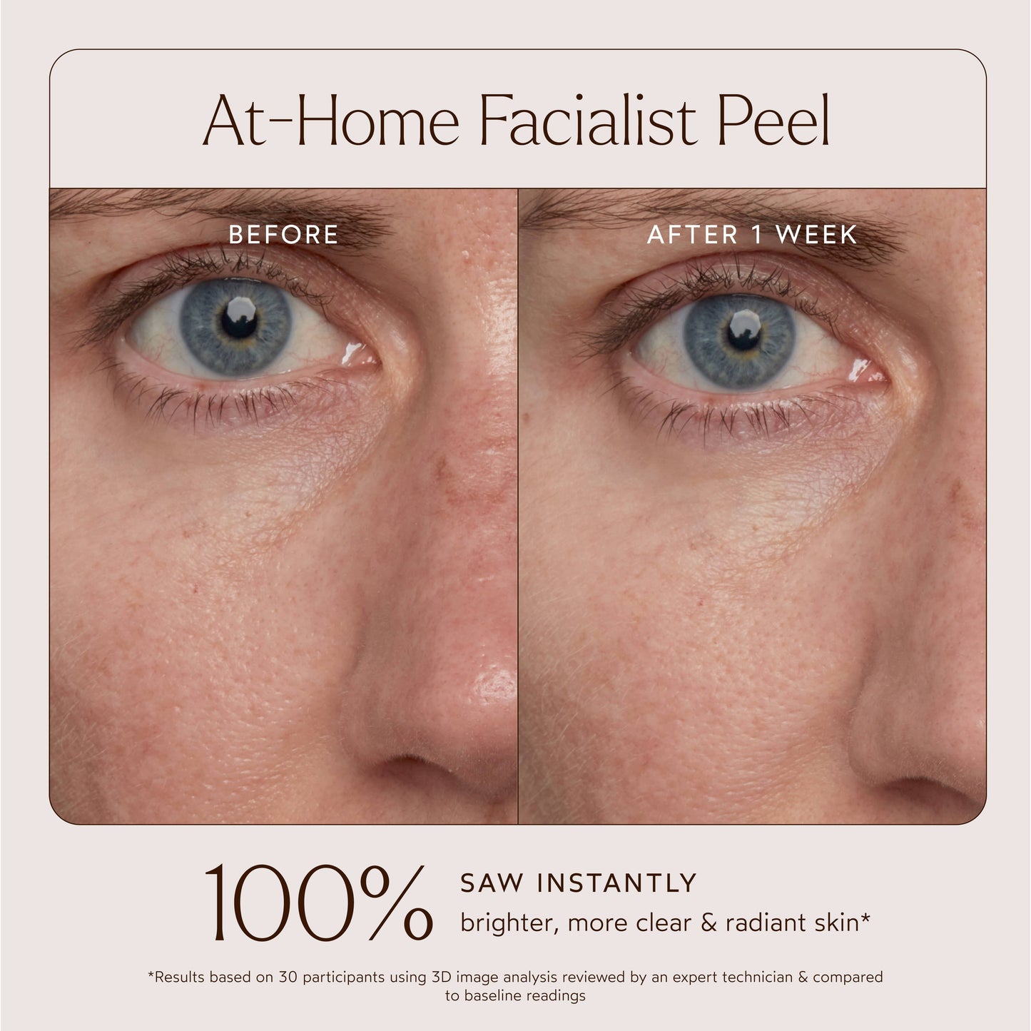 True Botanicals At-Home Facial Peel Treatment