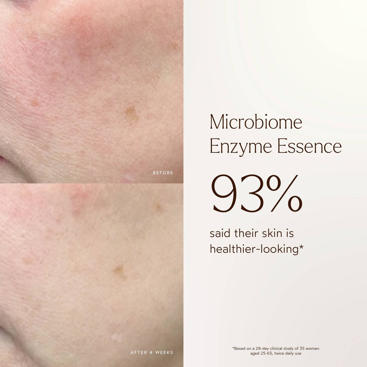 Renew Microbiome Enzyme Essence
