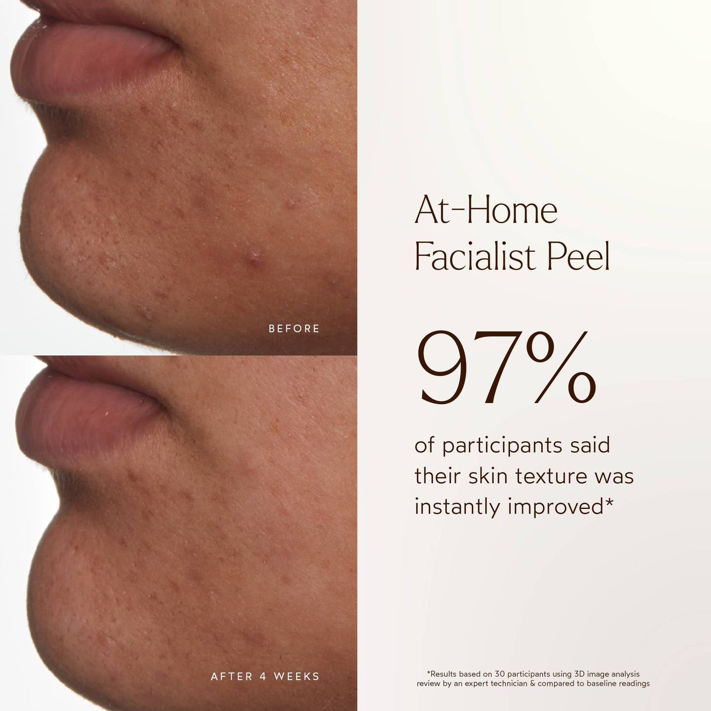 True Botanicals At-Home Facial Peel Treatment