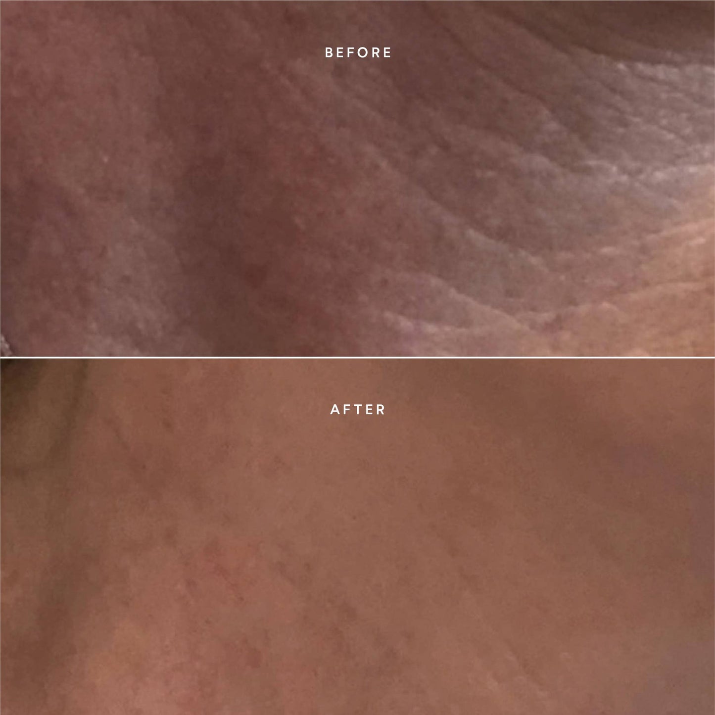 True Botanicals Renew Repair Nightly Treatment (formerly Repair Serum)